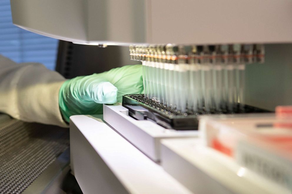 PHOTO: In this 2019 photo provided by Biogen, a researcher works on the development of the medication aducanumab in Cambridge, Mass.