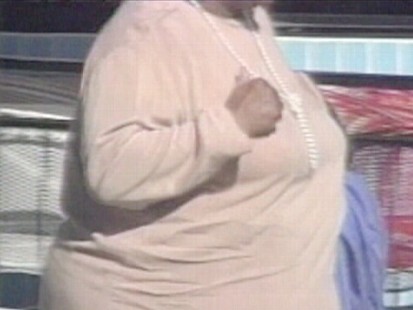 Obese Person