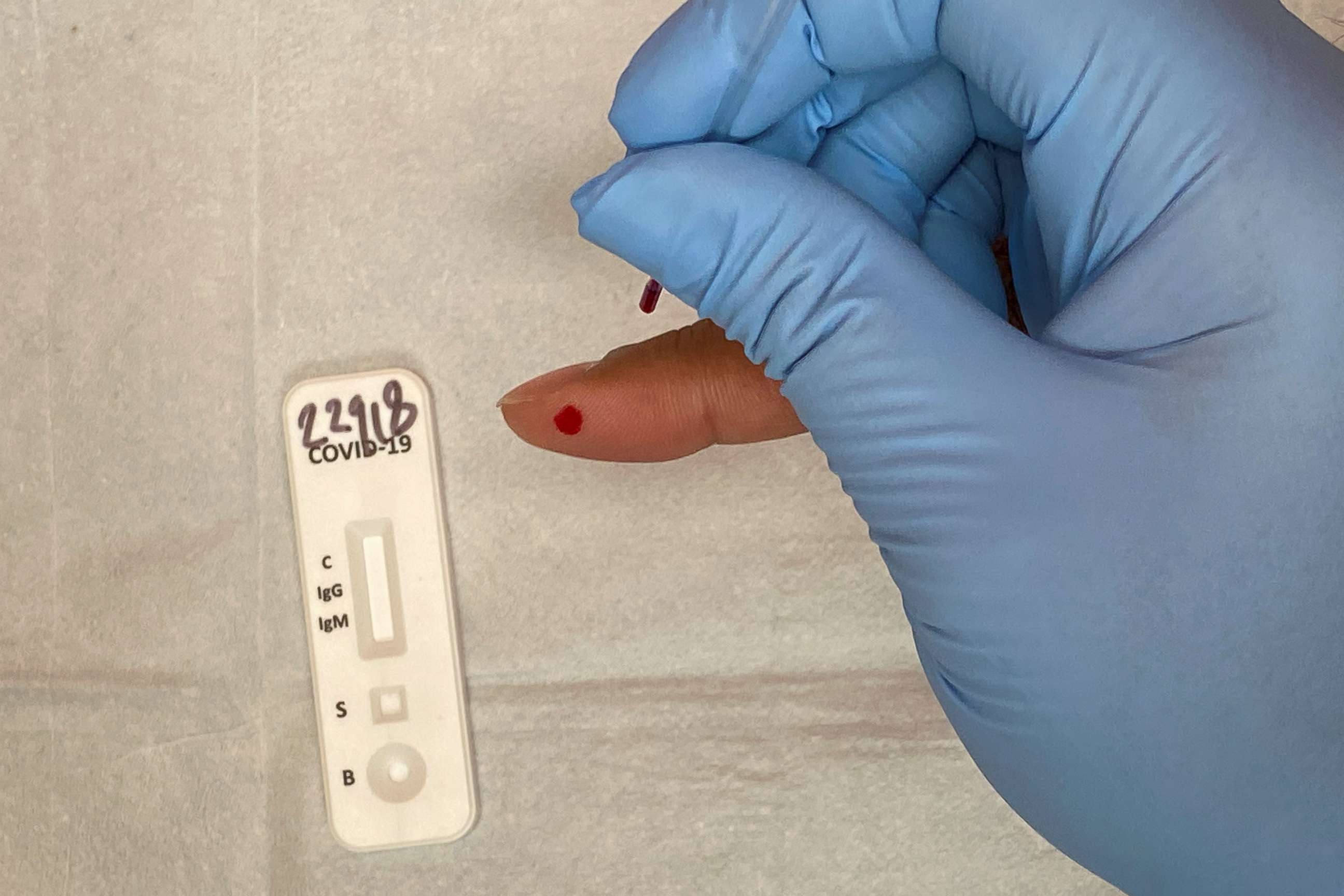 PHOTO: A medical practitioner takes a blood sample for the COVID 19 IgG and IgM Rapid Test, designed to detect the coronavirus antibodies, from a patient in Richmond, Texas, on April 25, 2020. 
