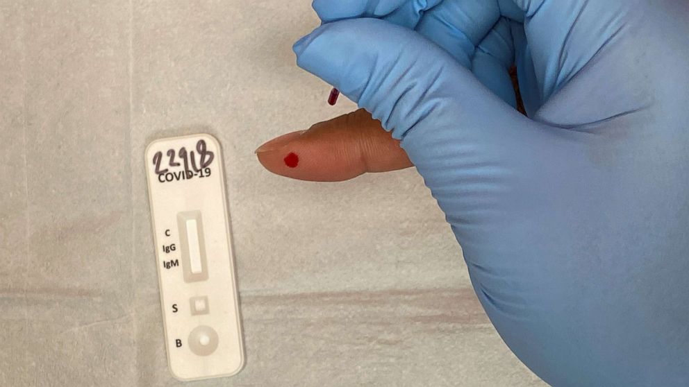 PHOTO: A medical practitioner takes a blood sample for the COVID 19 IgG and IgM Rapid Test, designed to detect the coronavirus antibodies, from a patient in Richmond, Texas, on April 25, 2020. 