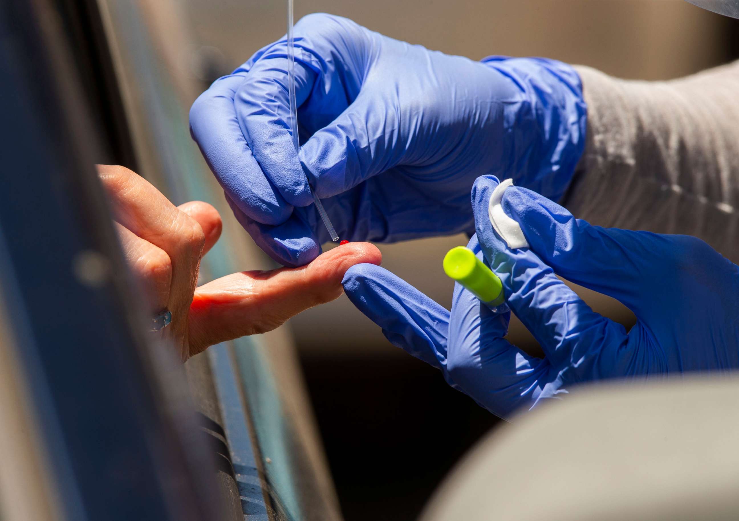 PHOTO: A member of myCovidMD administers a COVID-19 antibody blood test in Los Angeles, May 20, 2020.