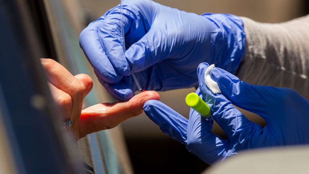 PHOTO: A member of myCovidMD administers a COVID-19 antibody blood test in Los Angeles, May 20, 2020.