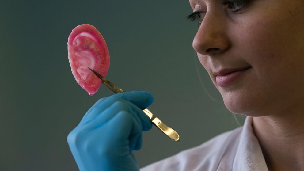 PHOTO: Dr. Michelle Griffin, a plastic research fellow, poses for photographs with a synthetic polymer ear at her research facility in the Royal Free Hospital in London, March 31, 2014. 