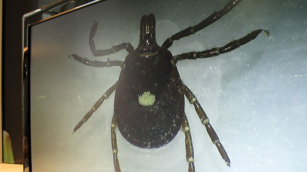 PHOTO: A lone star tick is displayed on a monitor in a lab at the North Carolina Museum of Natural Sciences, in Raleigh, N.C., July 31, 2014.