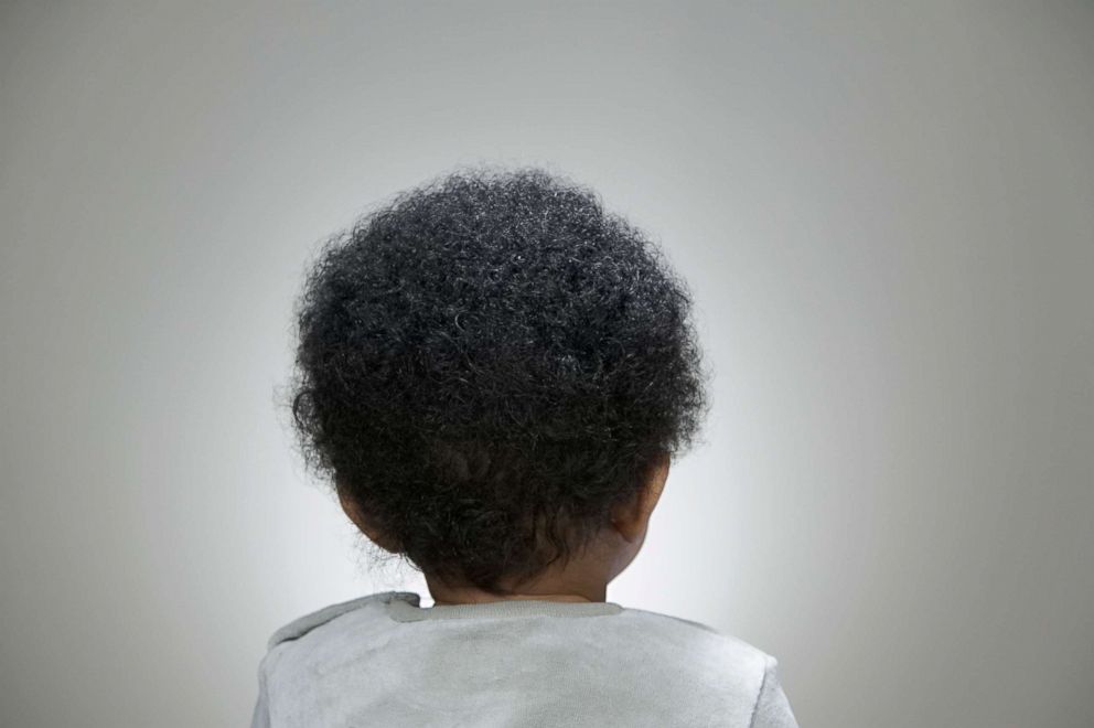 PHOTO: The back of a baby's head is seen in this undated stock photo.