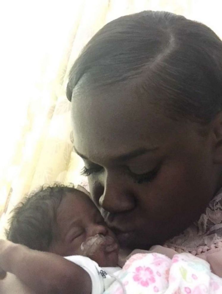 PHOTO: Angela Hughes kisses her daughter, Bella, who spent nearly three months in the NICU.