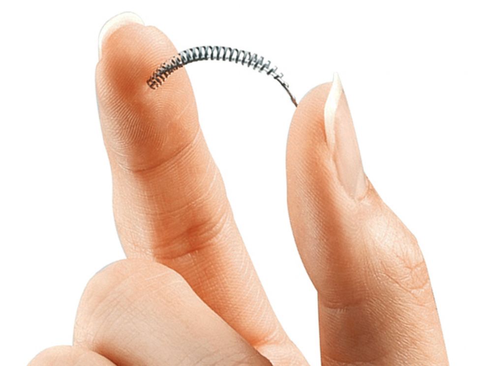 PHOTO: This image provided by Bayer Healthcare Pharmaceuticals shows the birth control implant Essure.