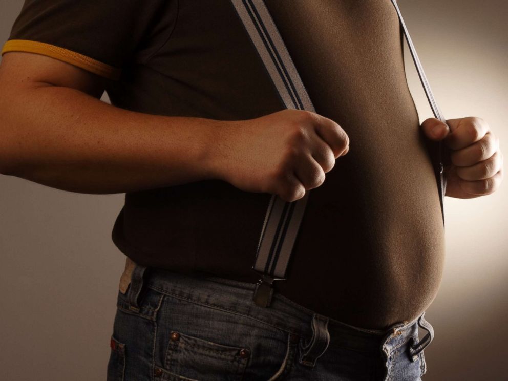 PHOTO: Individuals with more belly fat, even with normal or near-normal weight, have above average rates of heart disease and diabetes.