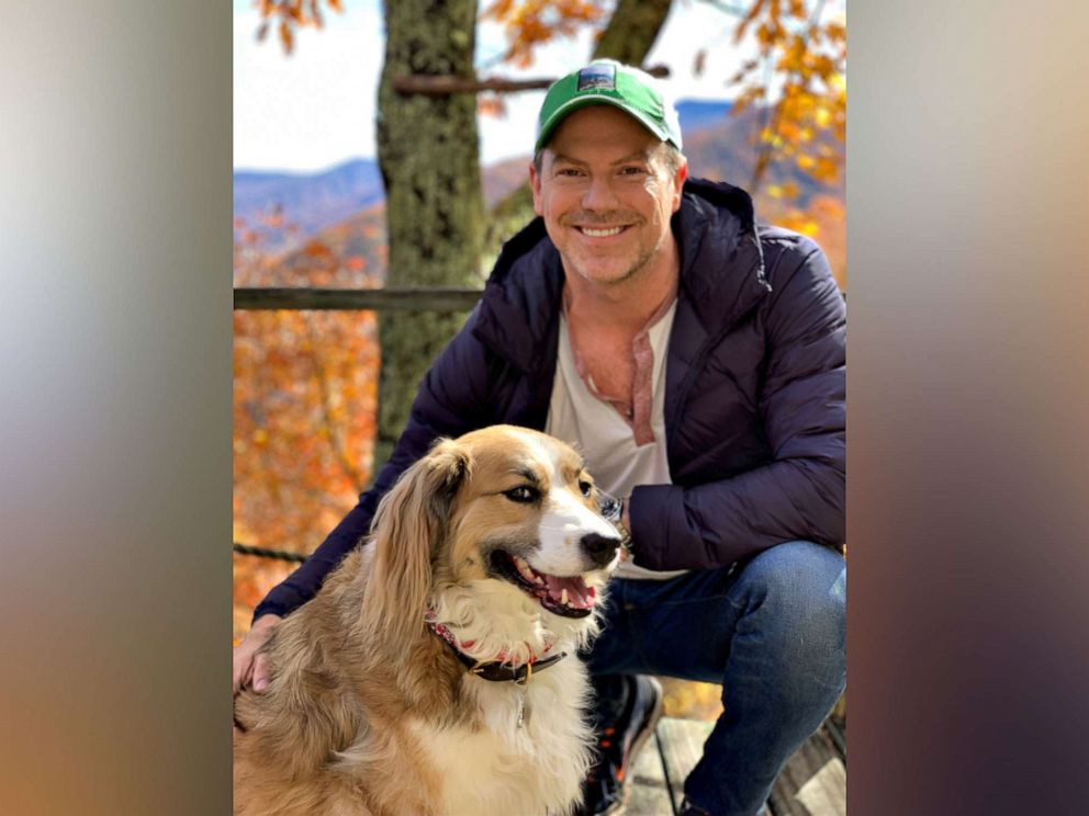 PHOTO: Atlanta resident Billy Roberts, 46, is pictured with his 5-year-old rescue dog George.