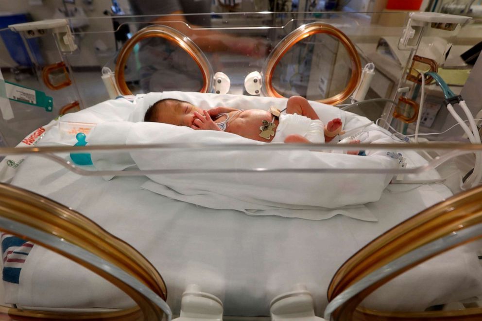 PHOTO: Two day-old David Alejandro Vega was being treated in the neonatal intensive care unit at Doctors Hospital at Renaissance in Edinbug, Texas, July 20, 2020. 