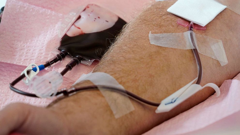 PHOTO: Tubes direct blood from a donor into a bag in Davenport, Iowa, November 11, 2022.