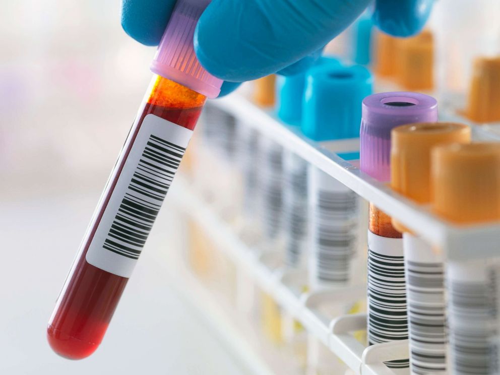 Blood samples are seen here in a stock photo.