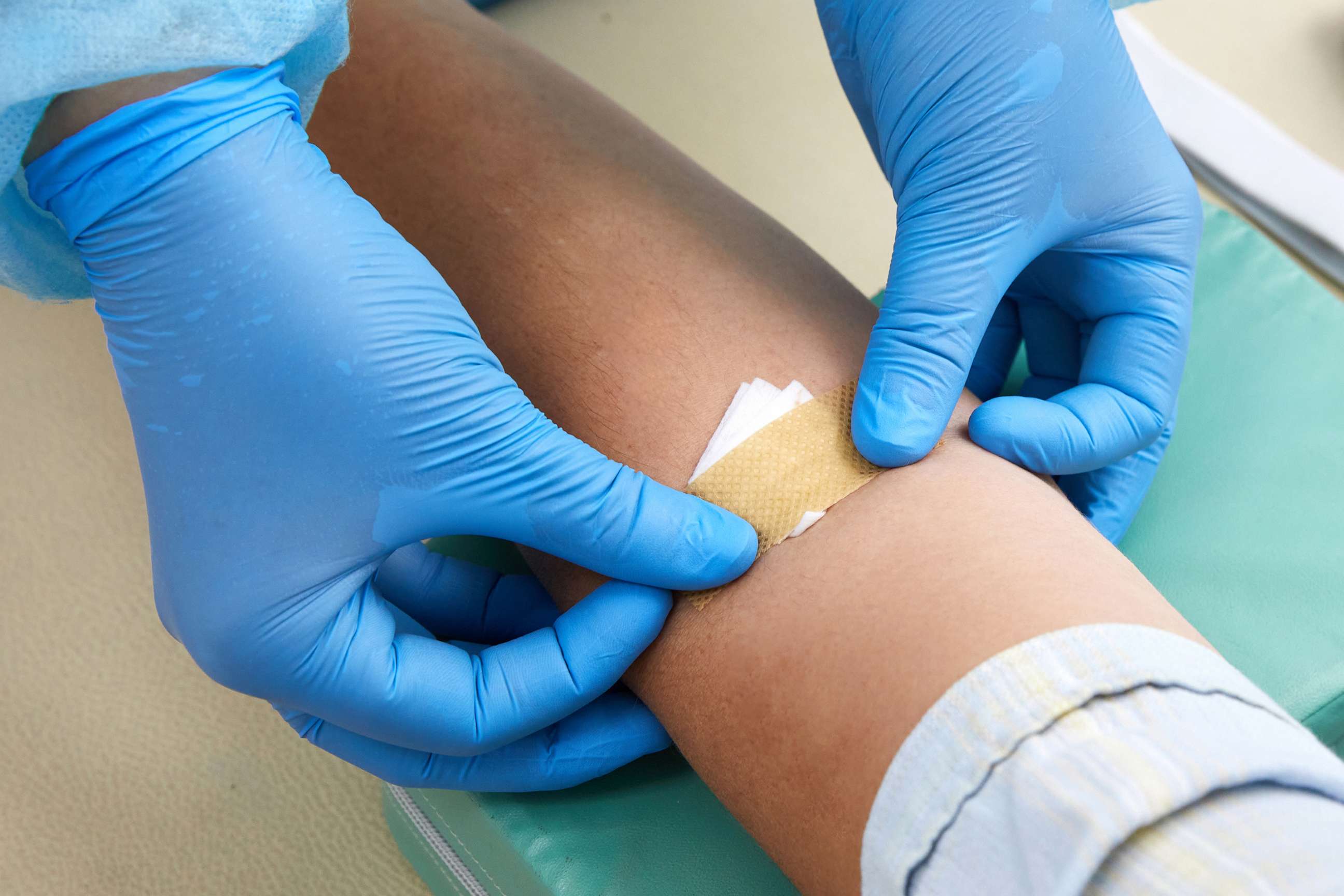 PHOTO: Nurse doing blood test from vein.