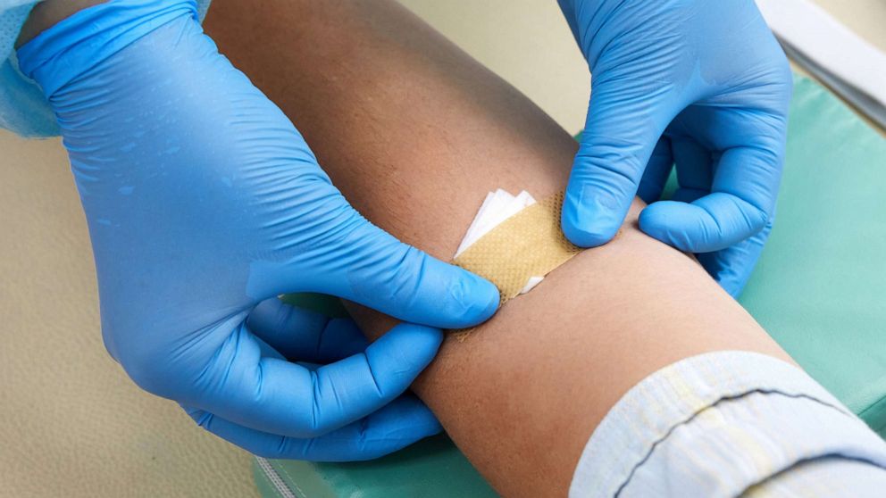 PHOTO: Nurse doing blood test from vein.