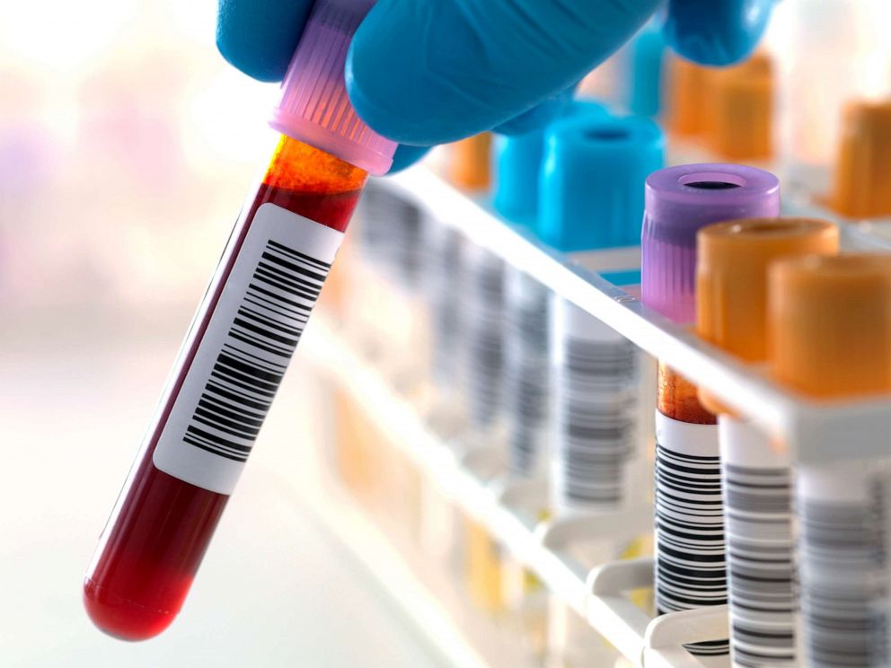 PHOTO: Blood samples are seen in this undated stock photo.