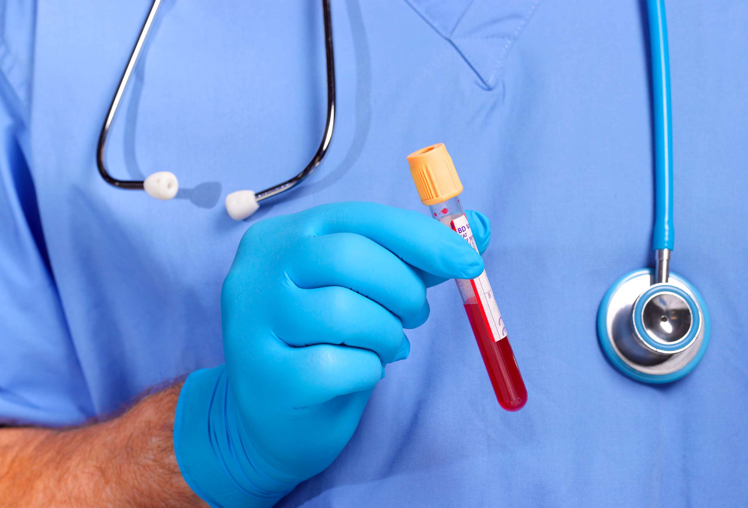 PHOTO: doctor in scrubs doing blood test