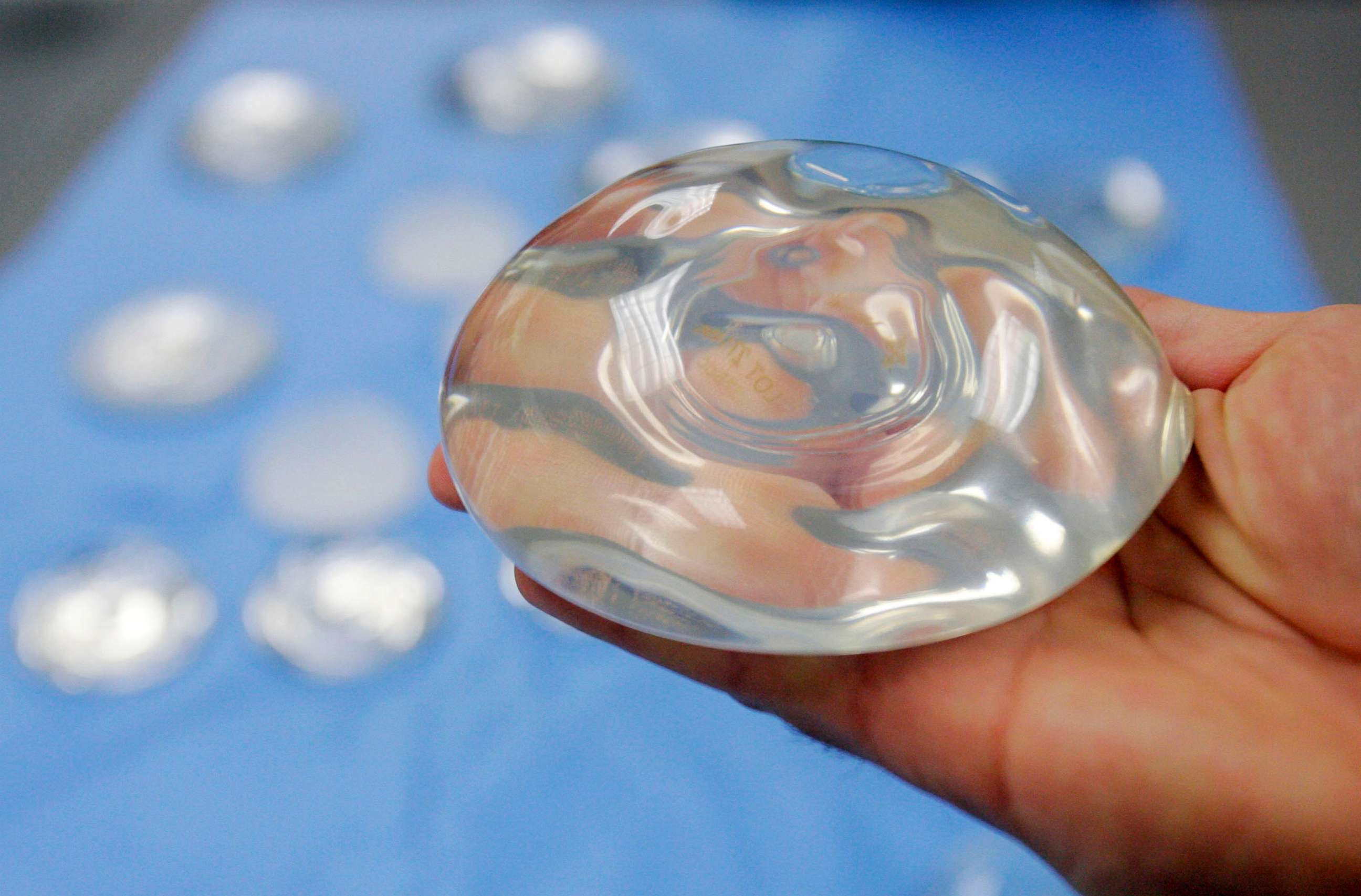 PHOTO: This Dec. 11, 2006, file photo shows a silicone gel breast implant in Irving, Texas.