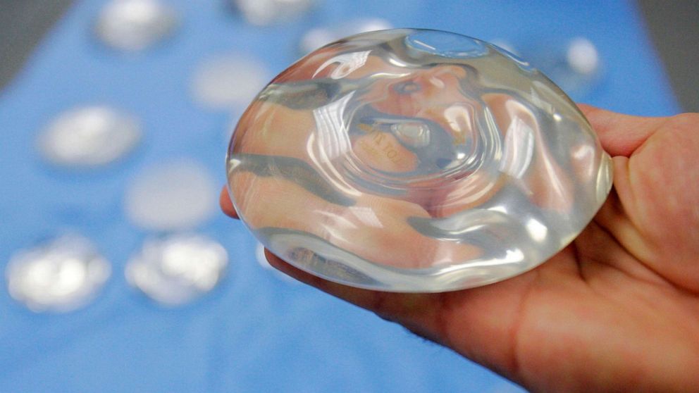 PHOTO: This Dec. 11, 2006, file photo shows a silicone gel breast implant in Irving, Texas.