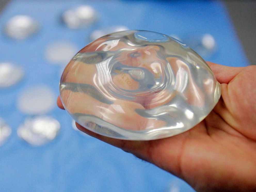 PHOTO: This Dec. 11, 2006, file photo shows a silicone gel breast implant in Irving, Texas.