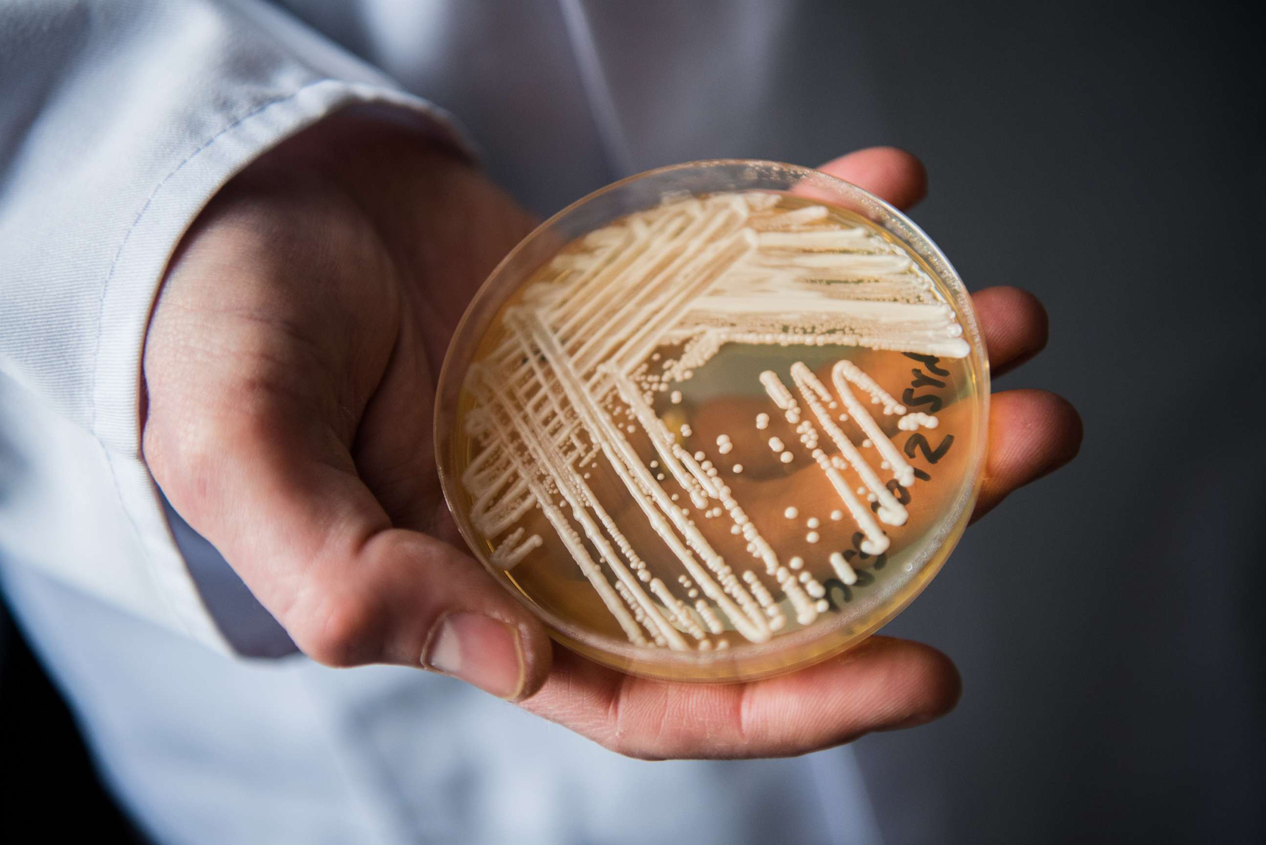 PHOTO: The director of the National Reference Centre for Invasive Fungus Infections, Oliver Kurzai, holds a petri dish containing the yeast candida auris, Jan. 23, 2018, in Wuerzburg, Germany.