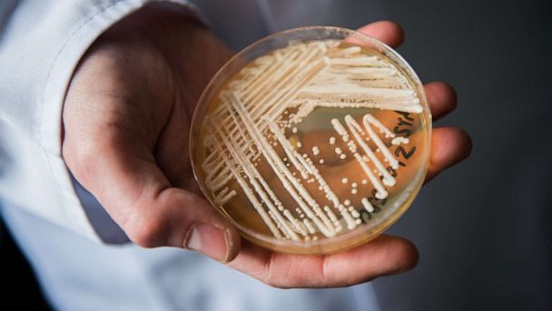 Why health departments are concerned about the spread of potentially deadly fungus