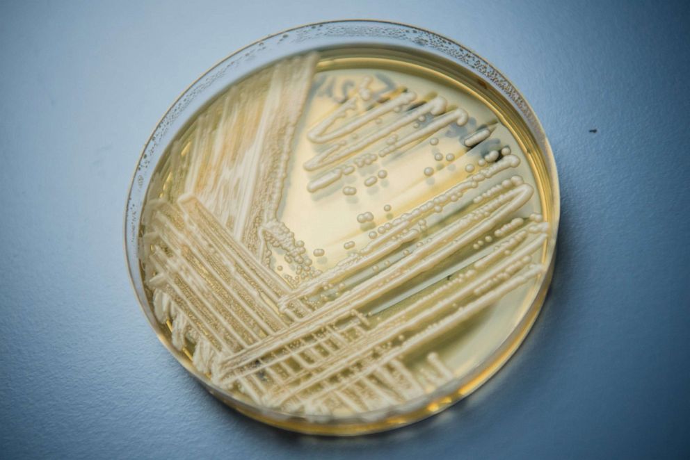 PHOTO: A petri dish holding the yeast candida auris is shown in a laboratory of Wuerzburg University, Jan. 23, 2018, in Wuerzburg, Germany.