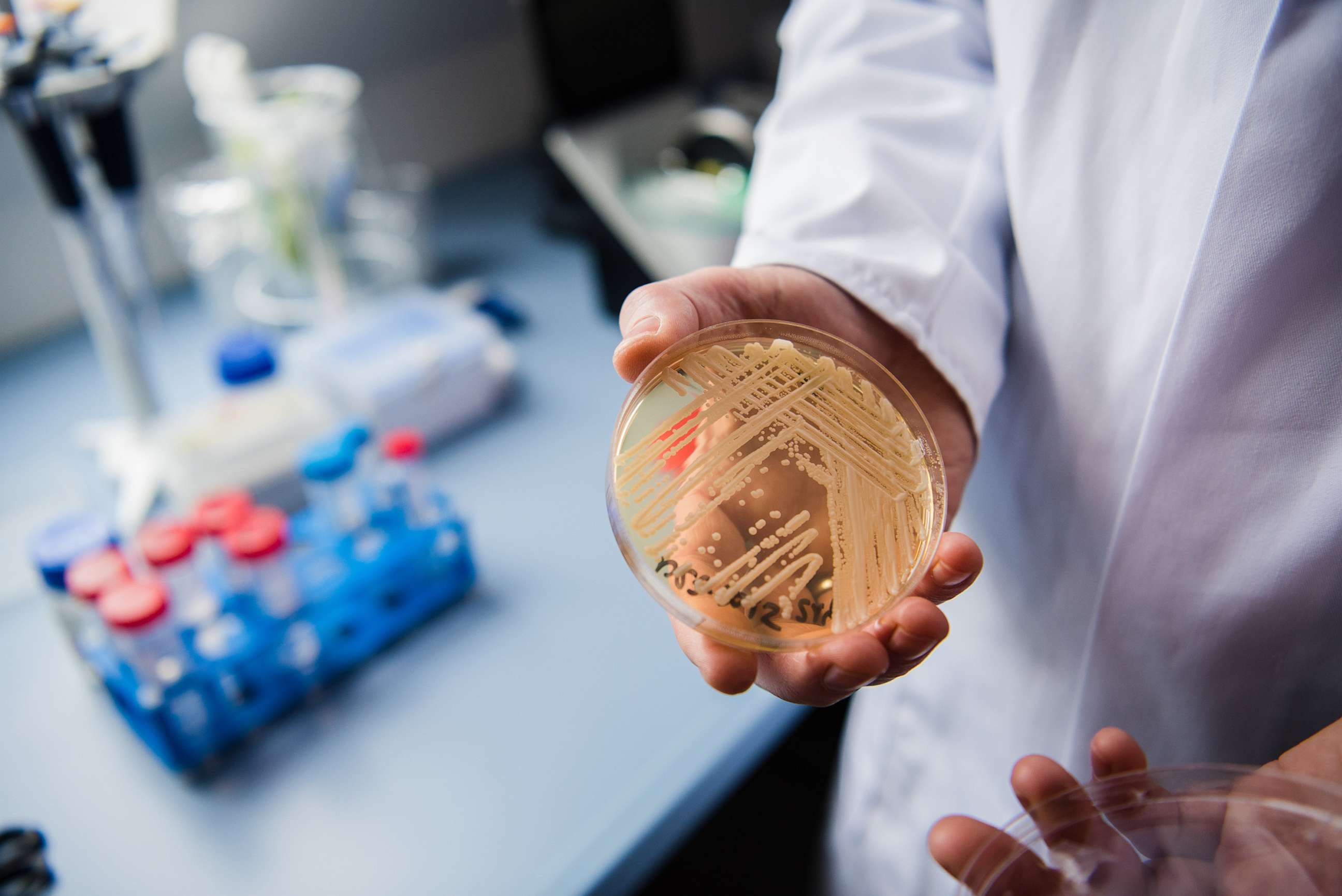 PHOTO: The director of the National Reference Centre for Invasive Fungus Infections, Oliver Kurzai, holdsa petri dish containing the yeast candida auris, Jan. 23, 2018, in Wuerzburg, Germany.