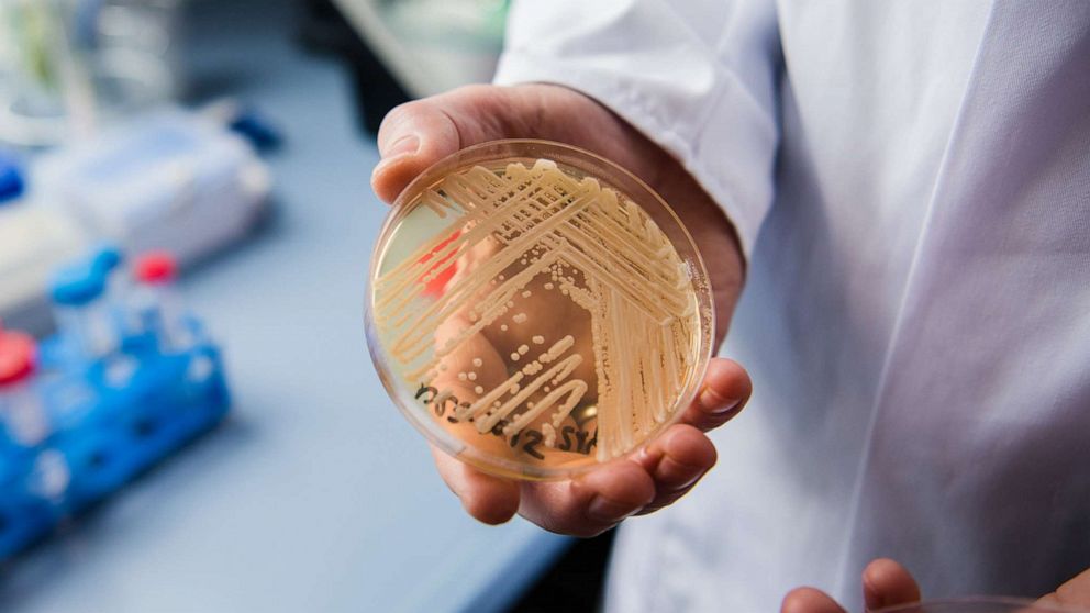 PHOTO: The director of the National Reference Centre for Invasive Fungus Infections, Oliver Kurzai, holdsa petri dish containing the yeast candida auris, Jan. 23, 2018, in Wuerzburg, Germany.