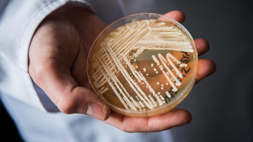 PHOTO: The director of the National Reference Centre for Invasive Fungus Infections, Oliver Kurzai, holds a petri dish holding the yeast candida auris in a laboratory of Wuerzburg University in Wuerzburg, Germany, January 23, 2018.