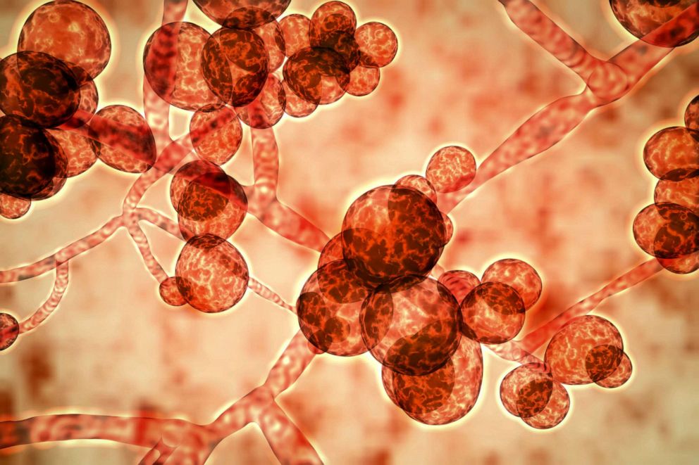 PHOTO: Computer illustration of the unicellular fungus (yeast) Candida auris.