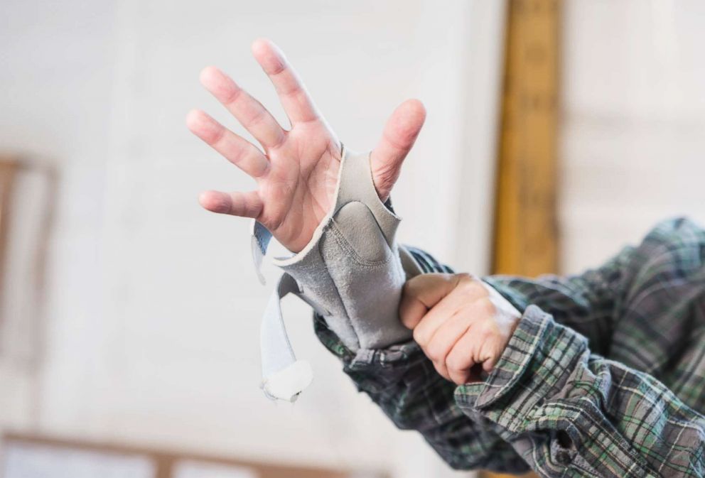 PHOTO: A woman puts a brace on her wrist to help with carpal tunnel syndrome in an undated stock photo. 