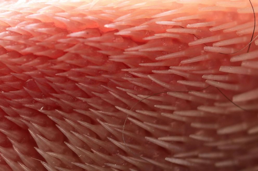 PHOTO: A close-up of cat's tongue, Nov. 19, 2018, courtesy of Alexis Noel at the Georgia Institute of Technology, Atlanta.