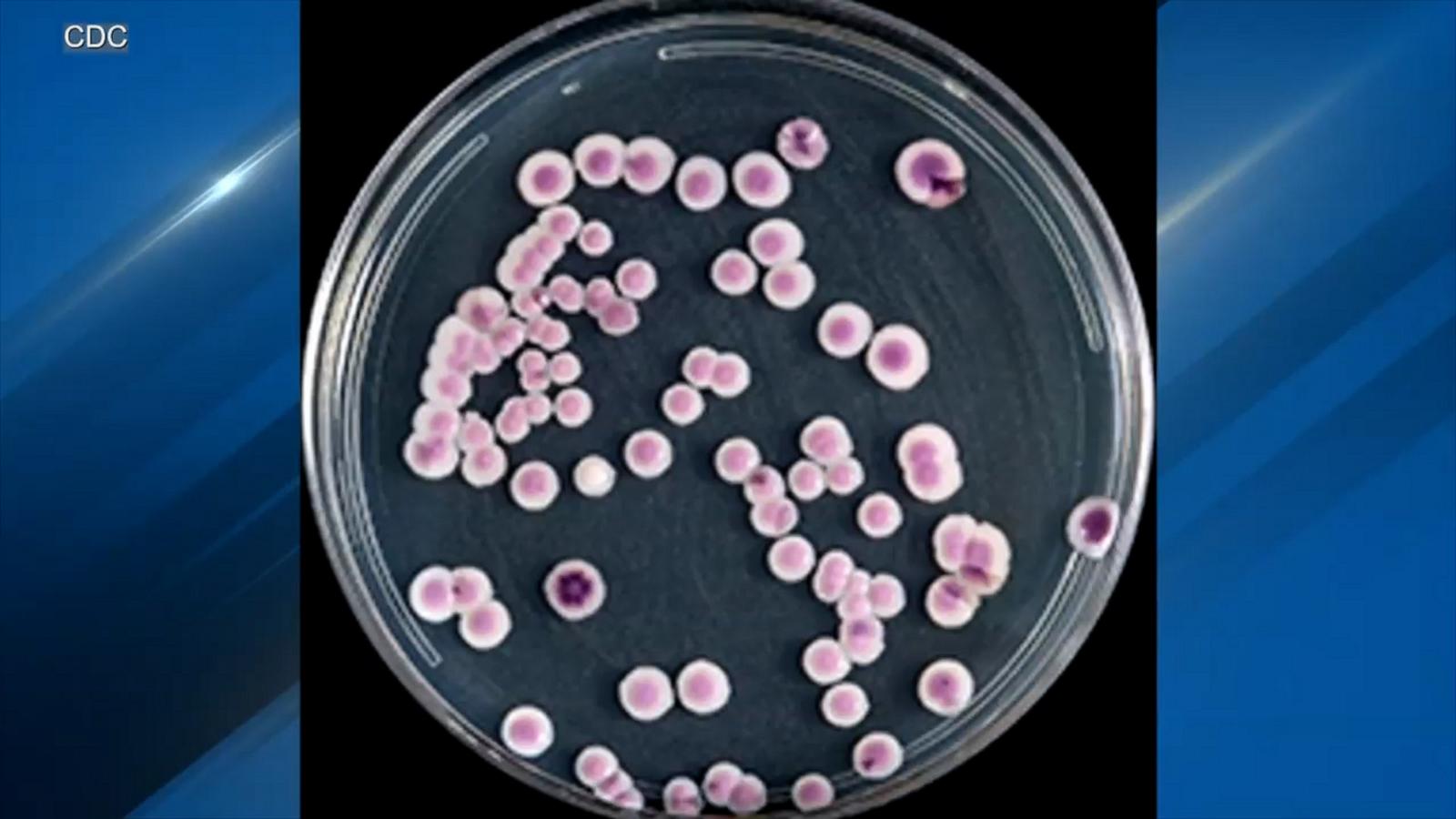 Washington state confirms 1st outbreak of C. auris fungus Good