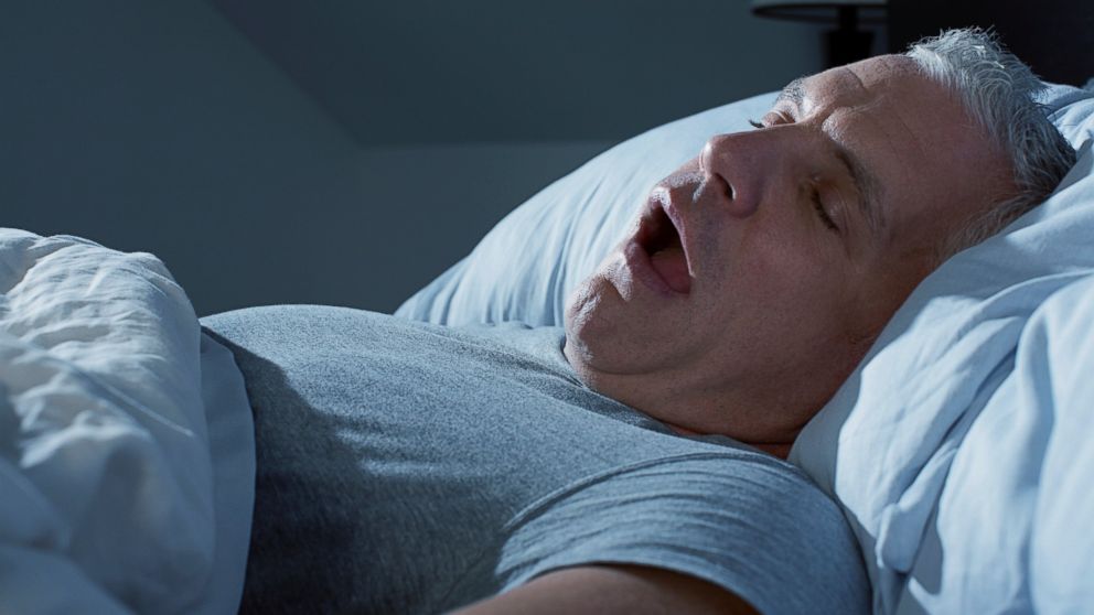Persistent snoring could be a sign of sleep apnea.