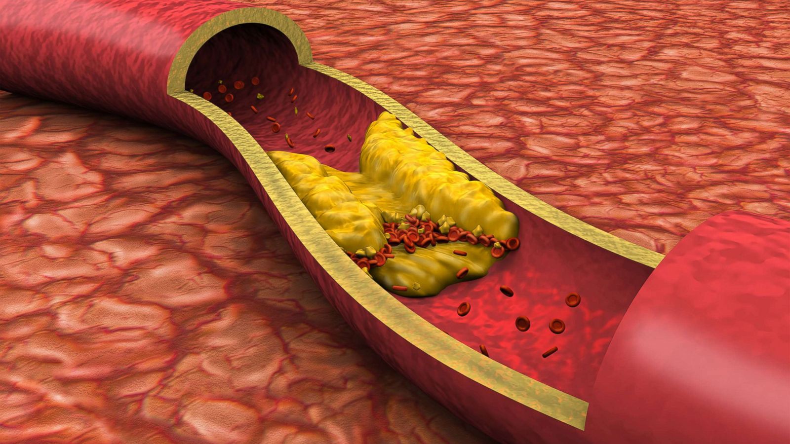 File:Cholesterol-from-xtal-3D-sk.png - Wikimedia Commons