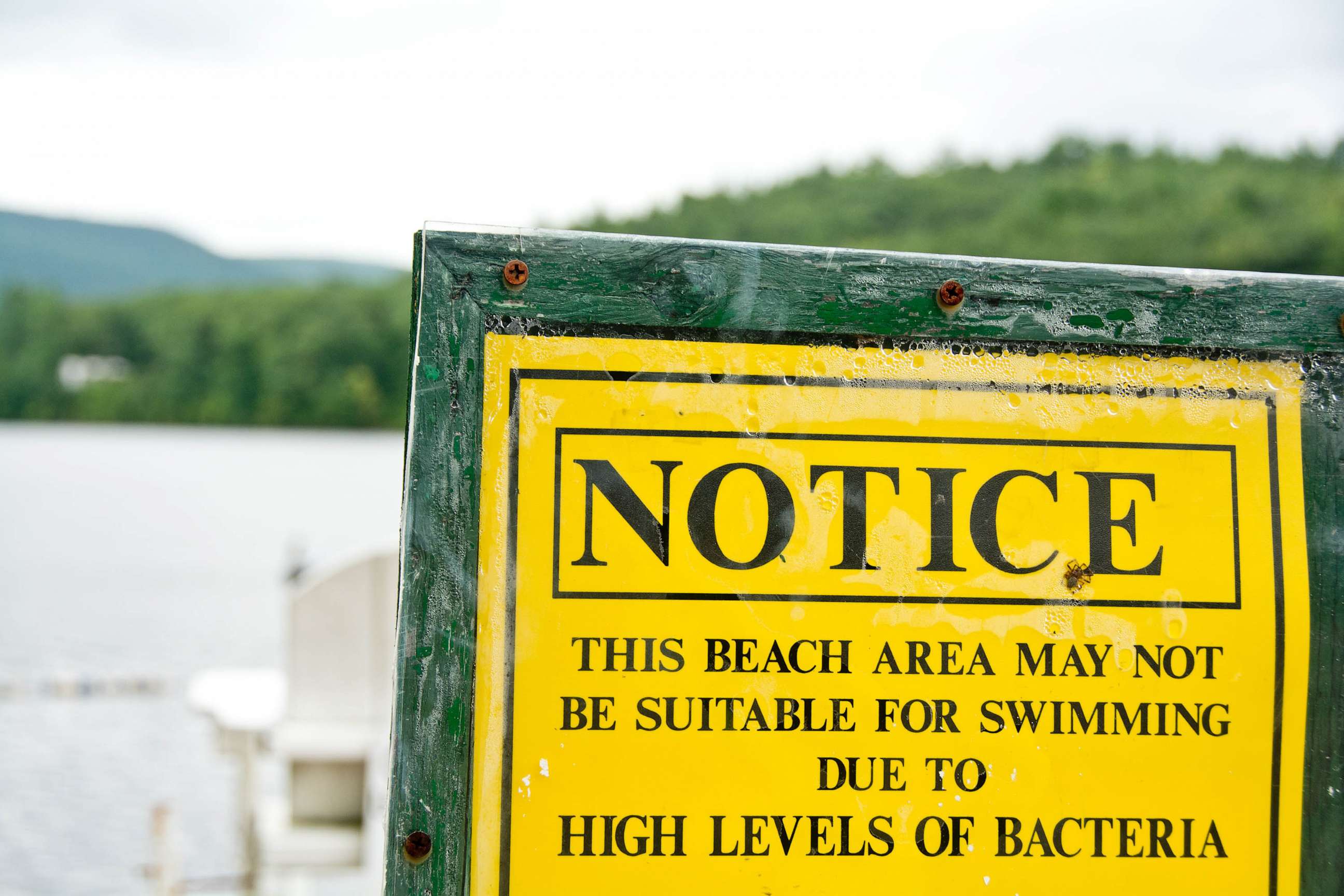 PHOTO: The beach is closed. The sign reads "Notice: this beach area may not be suitable for swimming due to high levels of bacteria".