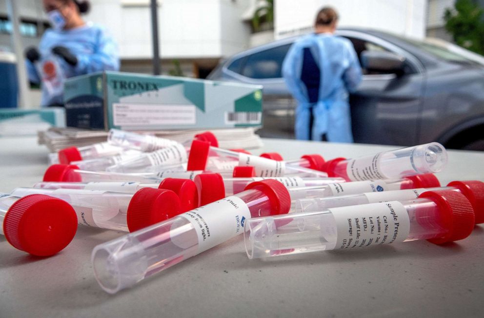 PHOTO: Workers conduct COVID-19 tests at the Mexican Consulate's parking lot in Miami, Aug. 15, 2020. The consulate, in partnership with LAB24 Laboratories, is providing free coronavirus testing to Mexican citizens that reside in Miami.