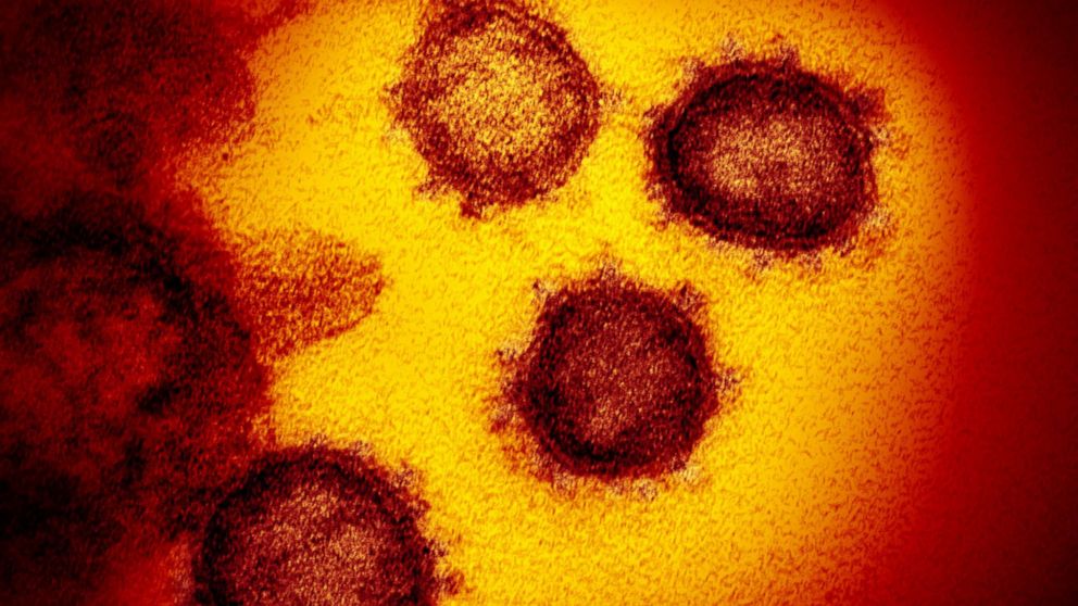 PHOTO: This transmission electron microscope image shows SARS-CoV-2-also known as 2019-nCoV, the virus that causes COVID-19-isolated from a patient in the U.S. 