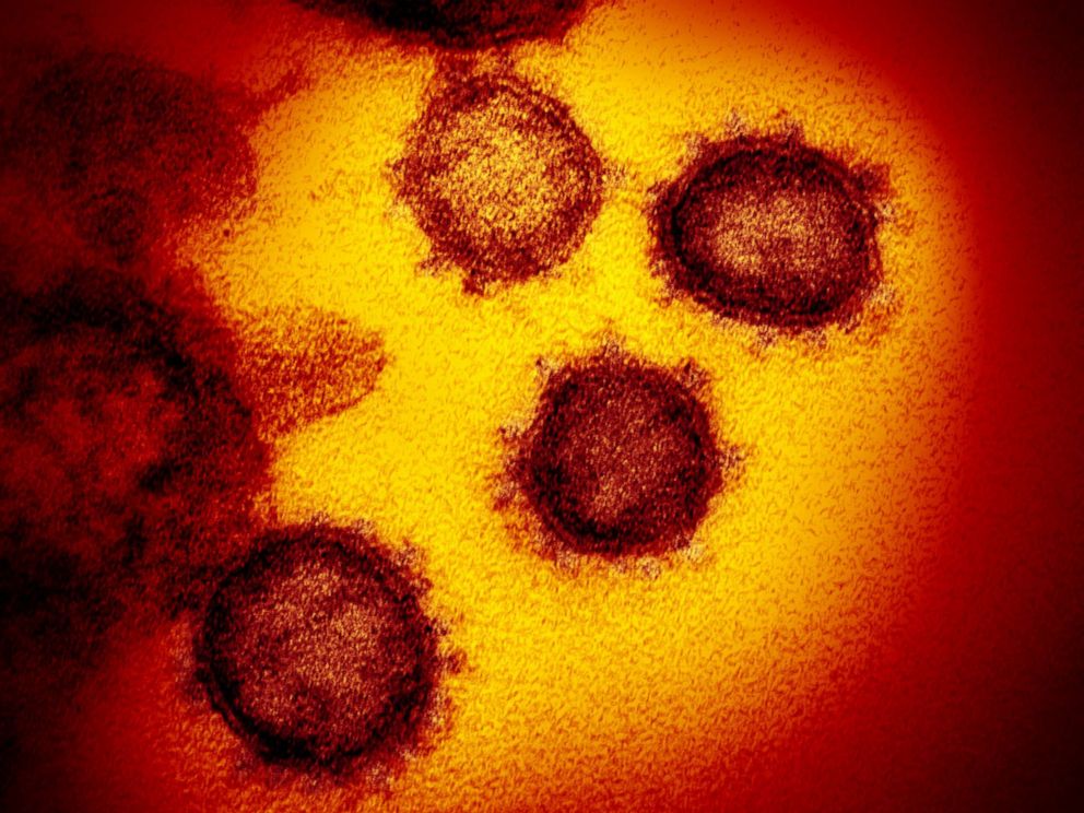 PHOTO: This transmission electron microscope image shows SARS-CoV-2-also known as 2019-nCoV, the virus that causes COVID-19-isolated from a patient in the U.S. 