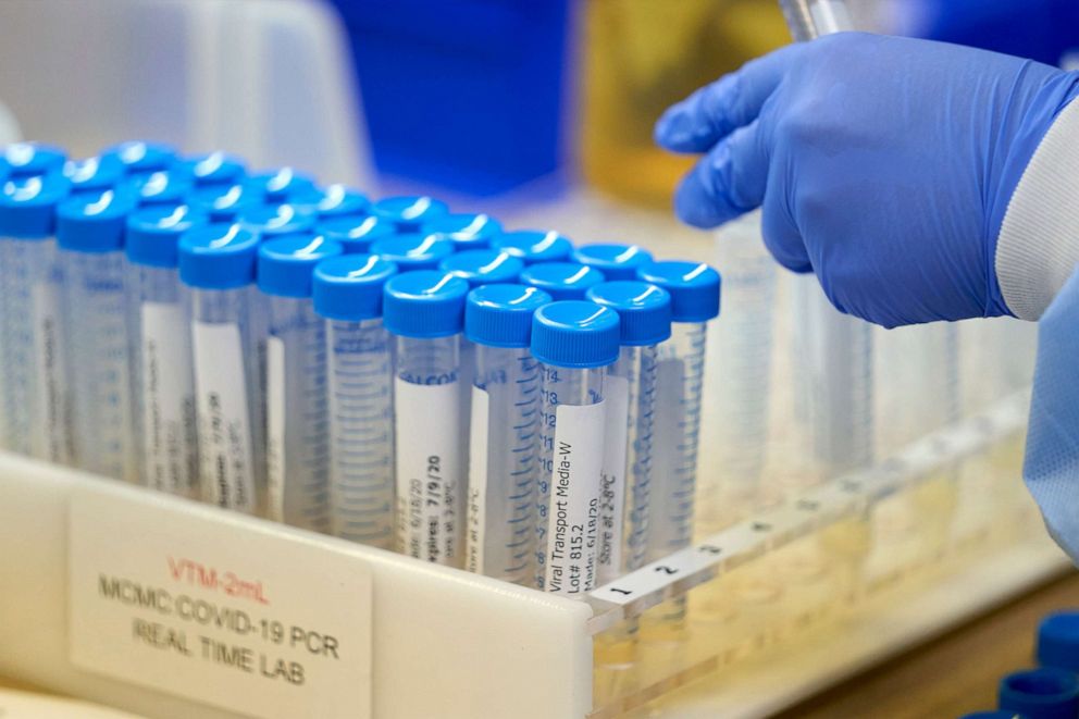 PHOTO: A lab at Methodist Dallas Medical Center prepares viral transport media for samples before collecting samples for coronavirus disease (COVID-19) in Dallas, June 24, 2020.  