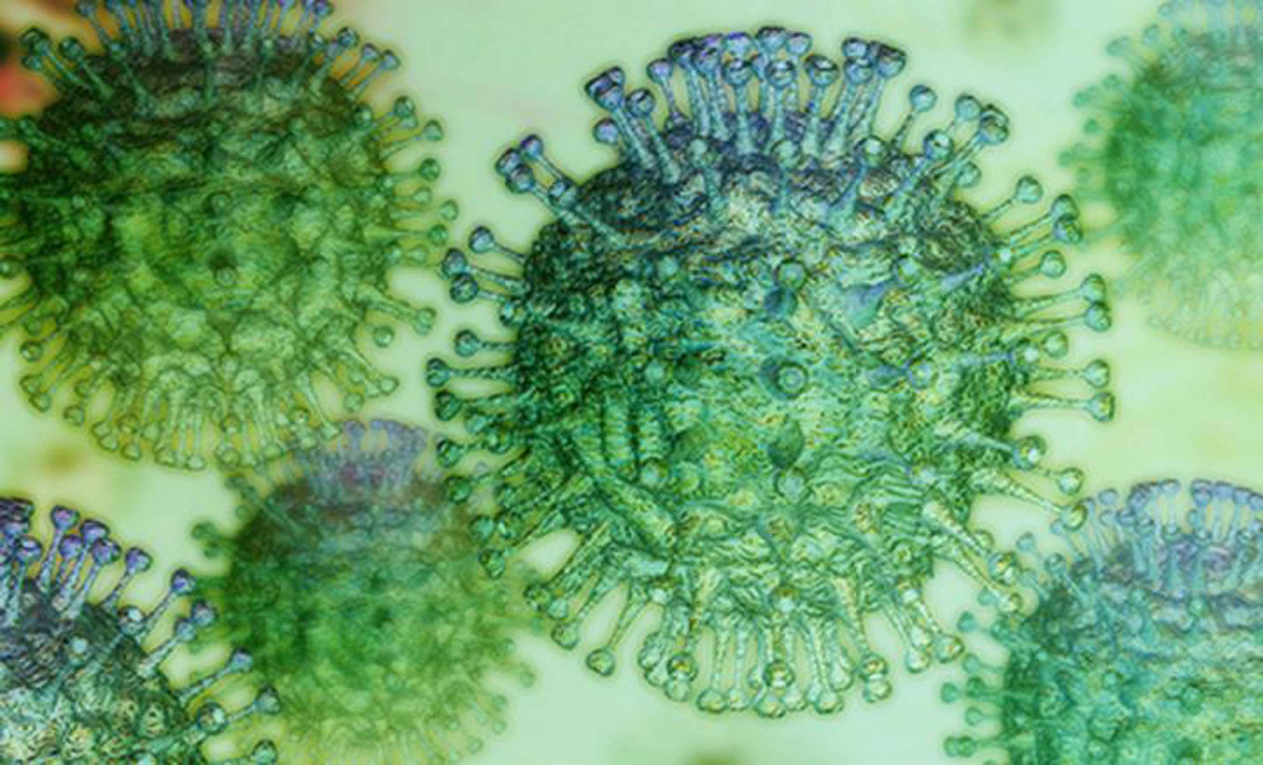 PHOTO: In this April 3, 2020, file photo, the COVID-19 coronavirus is shown.