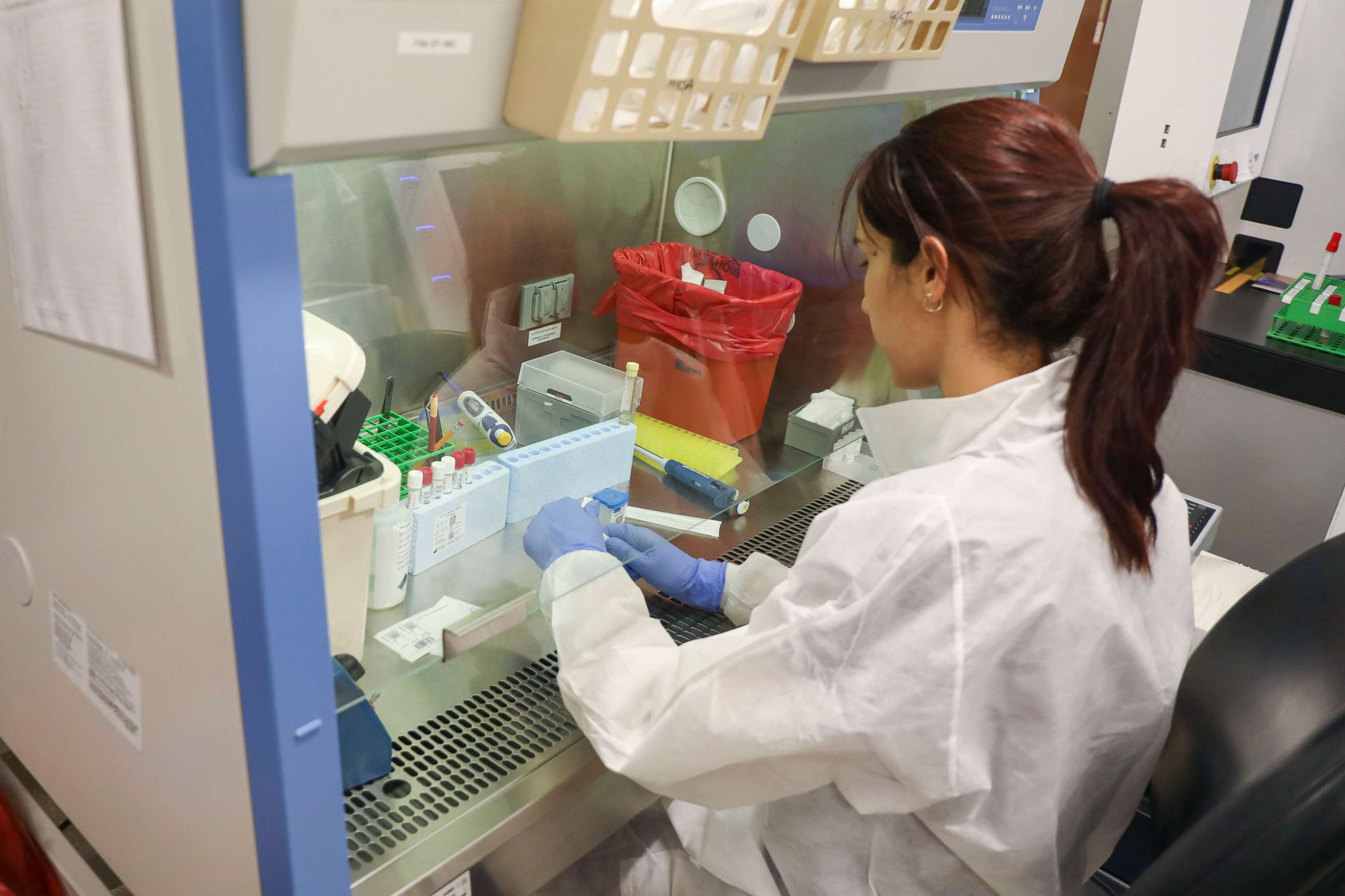 PHOTO: A lab technician with AdventHealth Tampa, works on a blood sample that was used to test a new machine now being used to test for the coronavirus, which causes COVID-19.