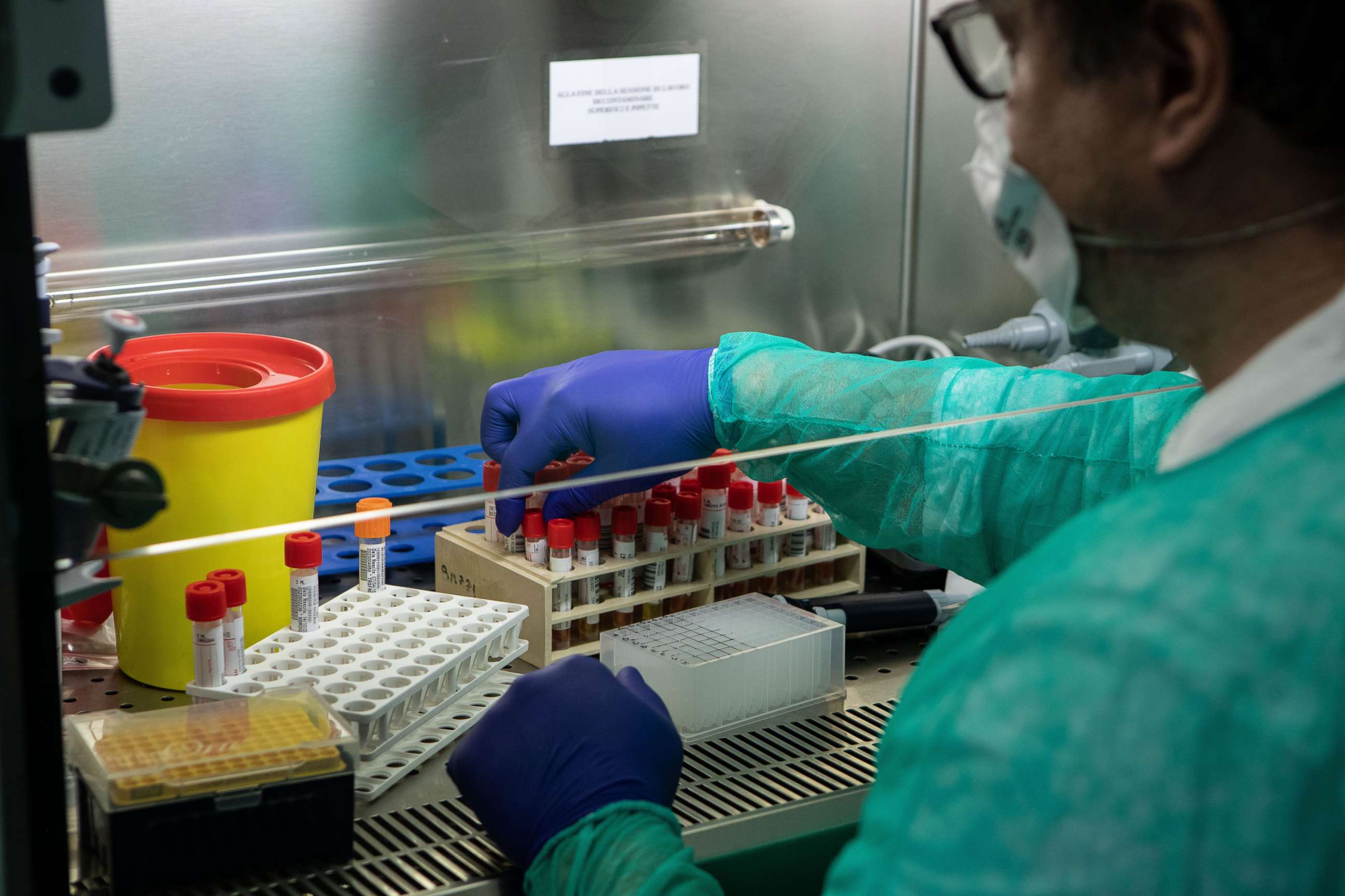 PHOTO: A lab worker tries to isolate the presence of Coronavirus during a swab test process in the Molecular biology laboratory of the Ospedale Niguarda, on March 05, 2020 in Milan, Italy. ages)