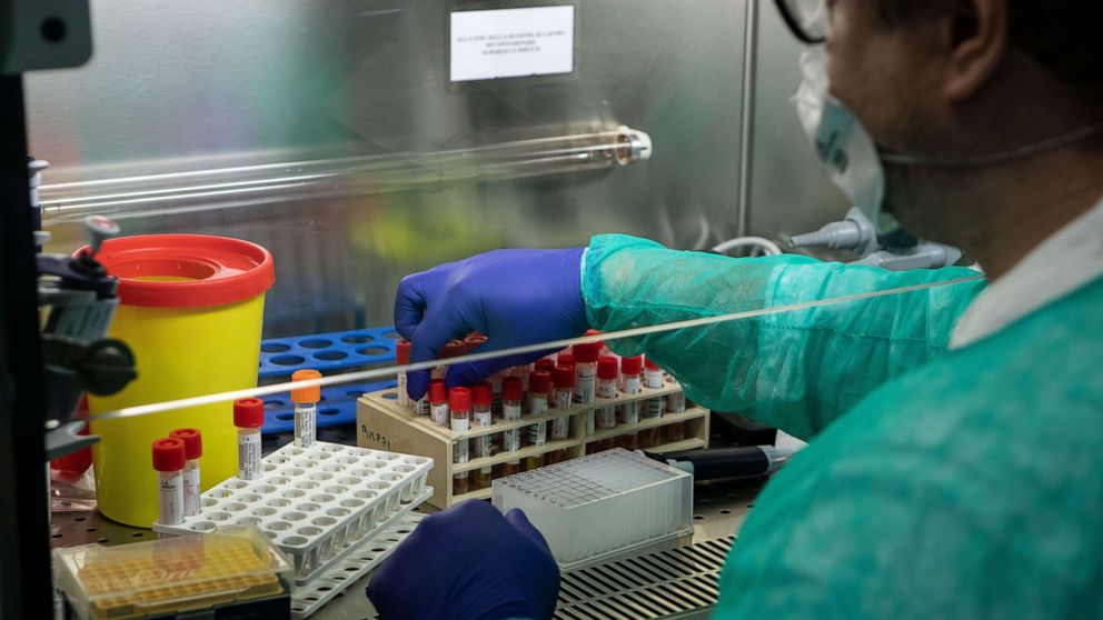 PHOTO: A lab worker tries to isolate the presence of Coronavirus during a swab test process in the Molecular biology laboratory of the Ospedale Niguarda, on March 05, 2020 in Milan, Italy. ages)