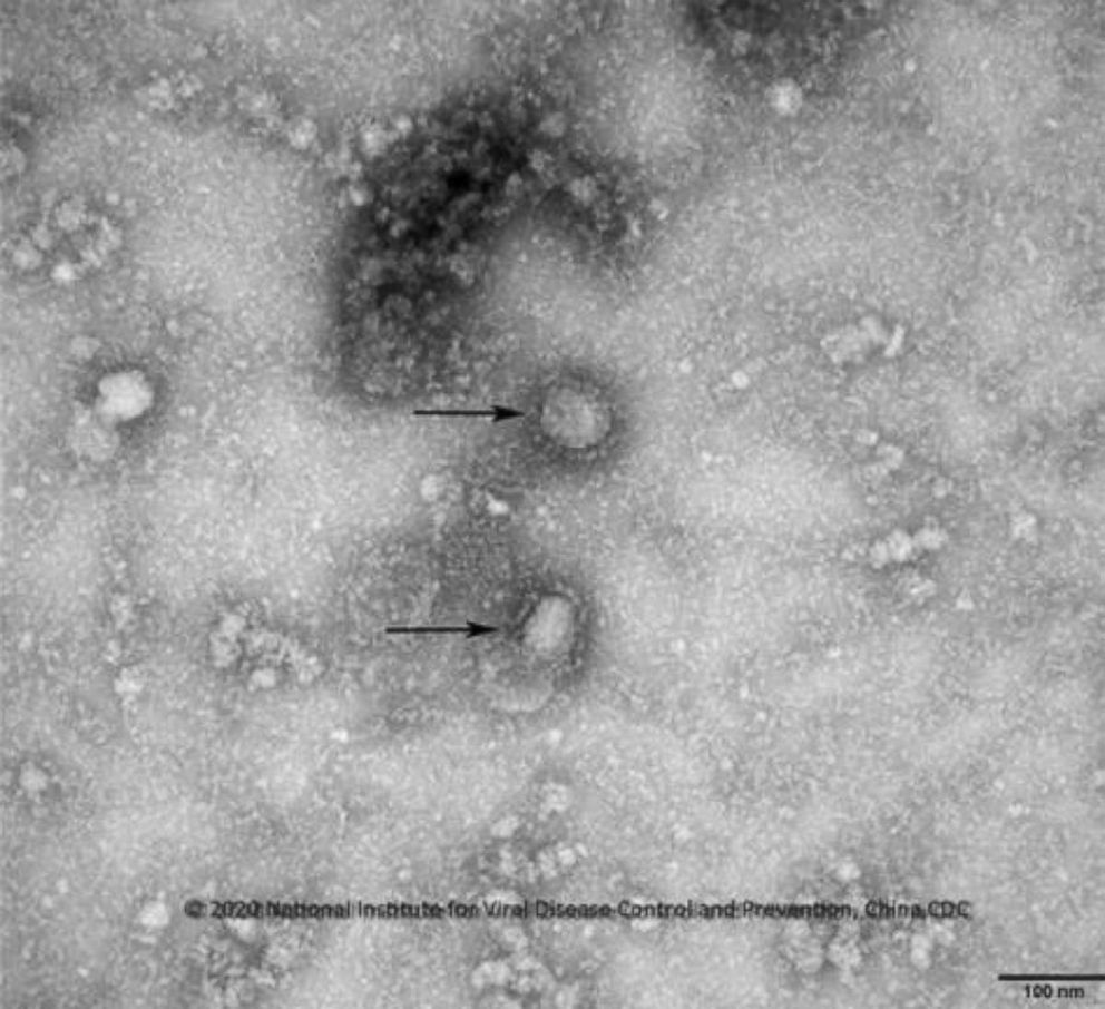 PHOTO: This photo, provided by the Korea Centers for Disease Control and Prevention, (KCDC), shows a new strain of the coronavirus. The KCDC said on Jan. 13, 2020, that the virus is strongly connected with severe acute respiratory syndrome (SARS).