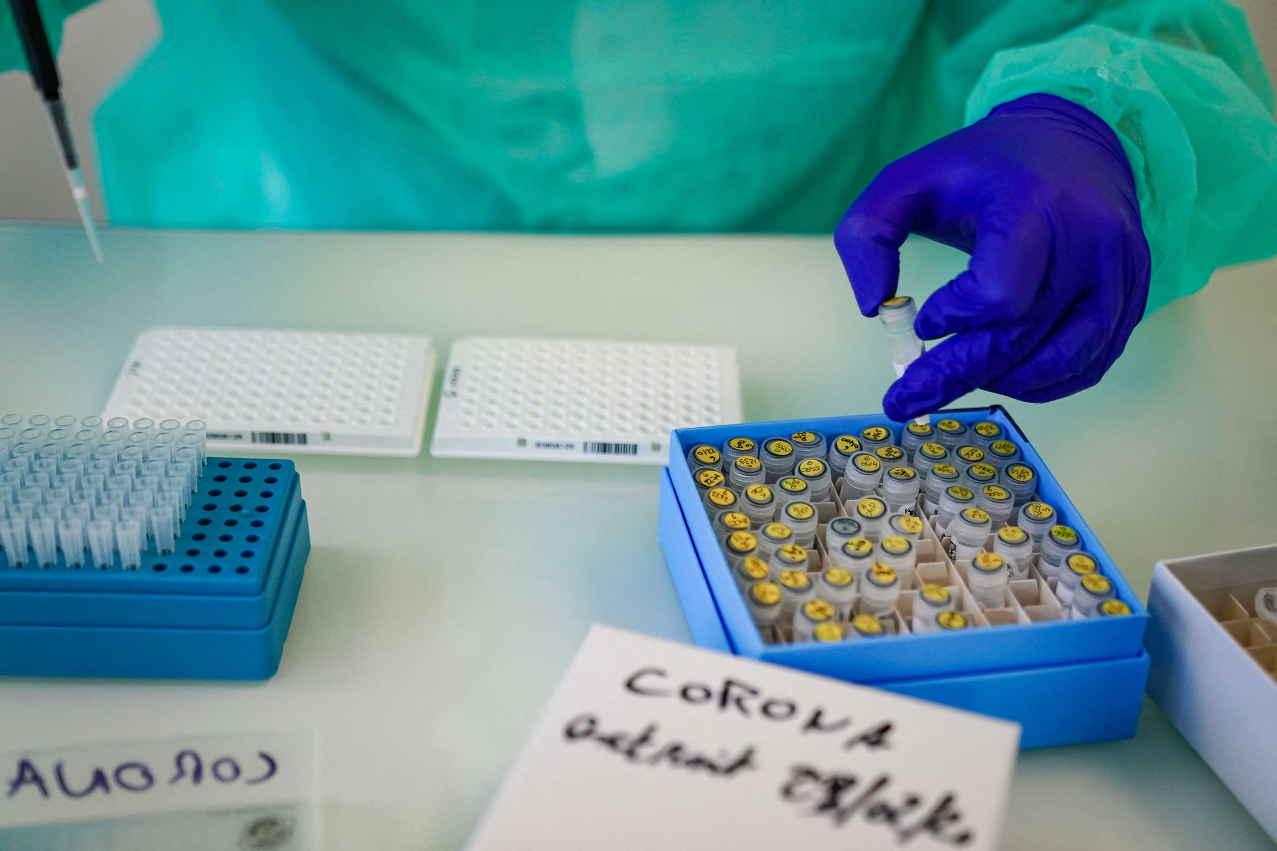 PHOTO: In this March 2, 2020, file photo,  a biologist analyzes Coronavirus tests at the facilities of the Institut Hospitalo-Universitaire Méditerranée Infection, in Marseille, France.