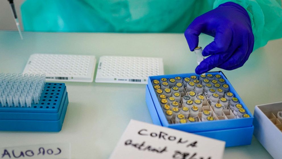 PHOTO: In this March 2, 2020, file photo,  a biologist analyzes Coronavirus tests at the facilities of the Institut Hospitalo-Universitaire Méditerranée Infection, in Marseille, France.
