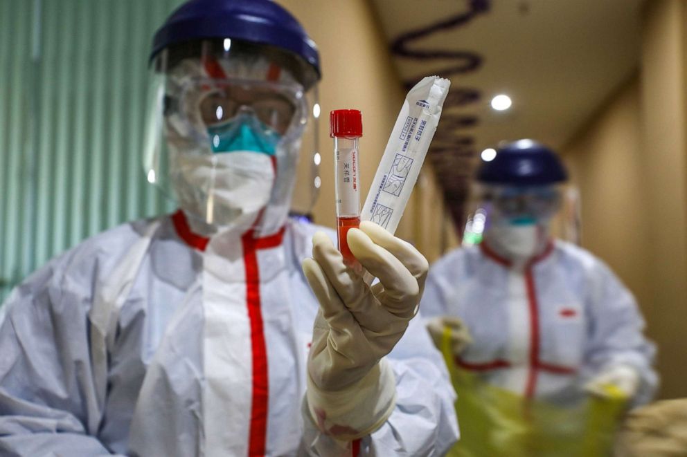 PHOTO: A member of the medical staff holds a test tube after taking samples taken from a person to be tested for the new coronavirus at a quarantine zone in Wuhan, the epicenter of the outbreak, in China's central Hubei province, Feb. 4, 2020.