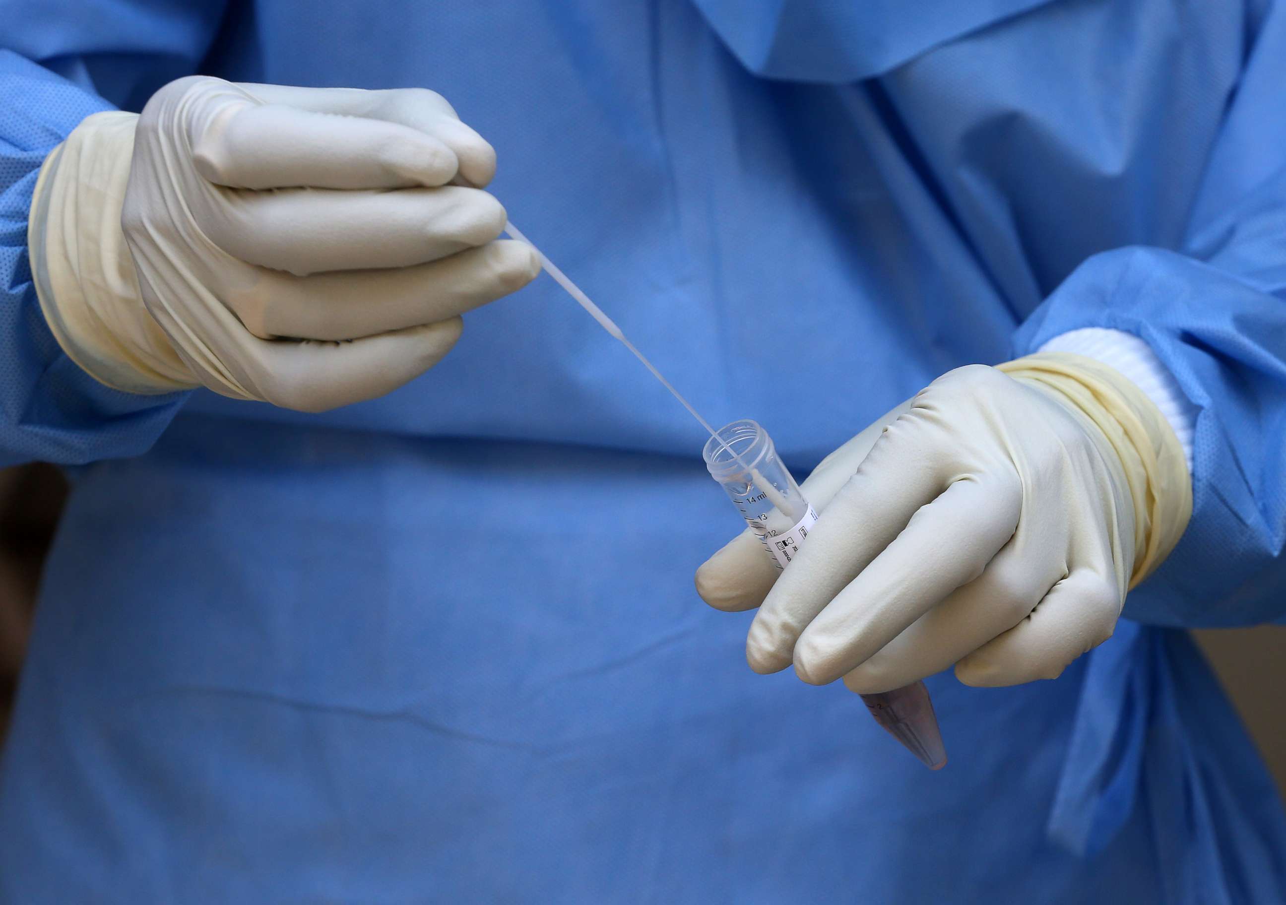 PHOTO: A doctor wearing a protective suit stores a swab in a test tube after taking it from a man to test for coronavirus disease (COVID-19),  April 8, 2020. 