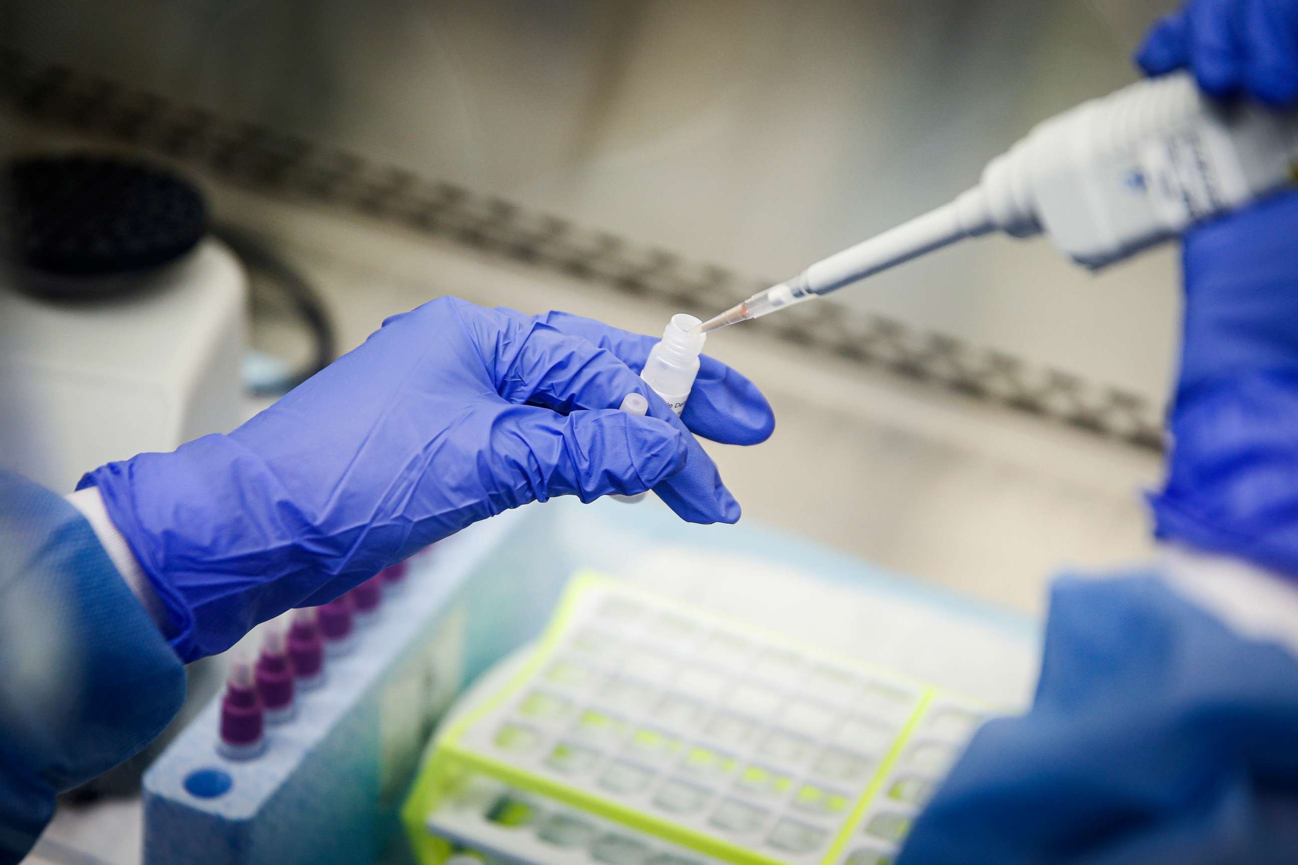 PHOTO: A laboratory technician prepares COVID-19 patient samples for semi-automatic testing at Northwell Health Labs, March 11, 2020, in Lake Success, N.Y.